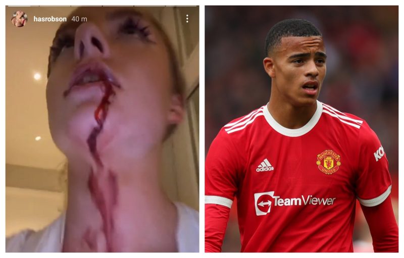 Bintang Manchester United belasah teman wanita hingga berdarah teruk